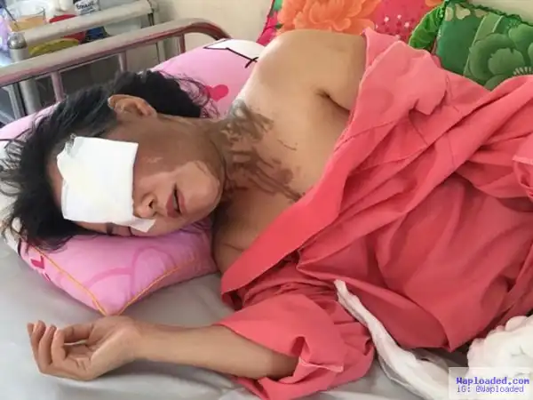 Photo: Woman Attacked With Acid By Her Ex-Husband After Refusing To Reconcile With Him